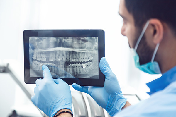 General Dentistry: Are Dental X-rays Recommended? from Allstar Dental in Garden Grove, CA