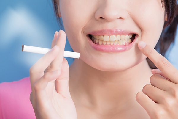 General Dentistry: How Smoking Can Harm Your Teeth from Allstar Dental in Garden Grove, CA