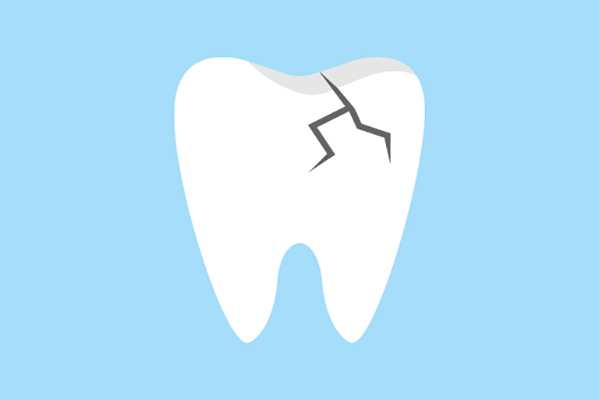 General Dentistry Treatments for a Damaged Tooth from Allstar Dental in Garden Grove, CA