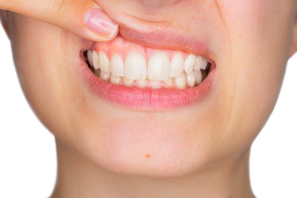 Preventive Dentistry Tips For Gum Disease