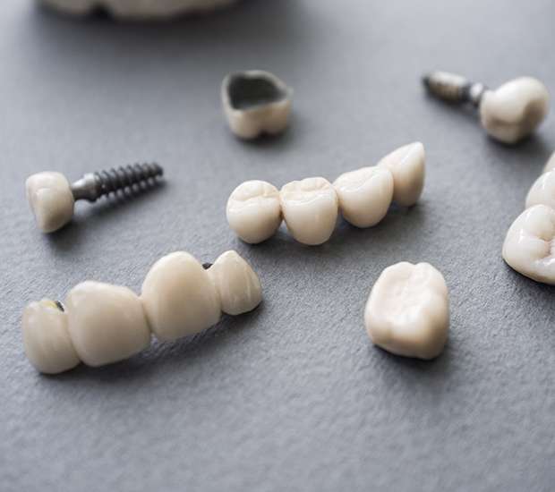 Garden Grove The Difference Between Dental Implants and Mini Dental Implants